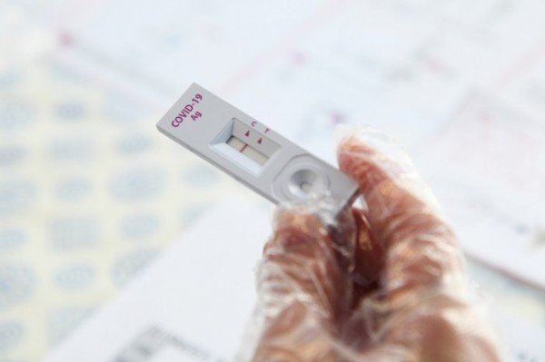 신속항원검사 결과 확인하는 모습 (8).JPG